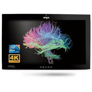 Onyx ACCEL-A3201 i7 32" 4K OR Station PCAP Touch