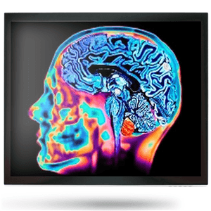 Onyx Onyx MEDDP-415HNN 15" Medical Display NX1107