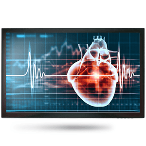 Onyx Onyx MEDDP-615HPN 15.6" Medical Touch Display NX1114