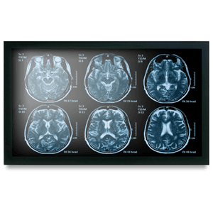 Onyx Onyx MEDDP-622HPN 21.5" Medical Touch Display NX1128
