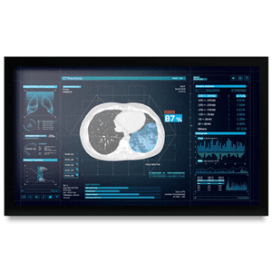 Onyx Onyx MEDDP-627HPN 27" Medical Touch Display NX1156