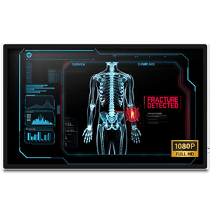 Onyx Onyx MEDDP-632F-P1 32" FHD Medical Touch Display NX1170